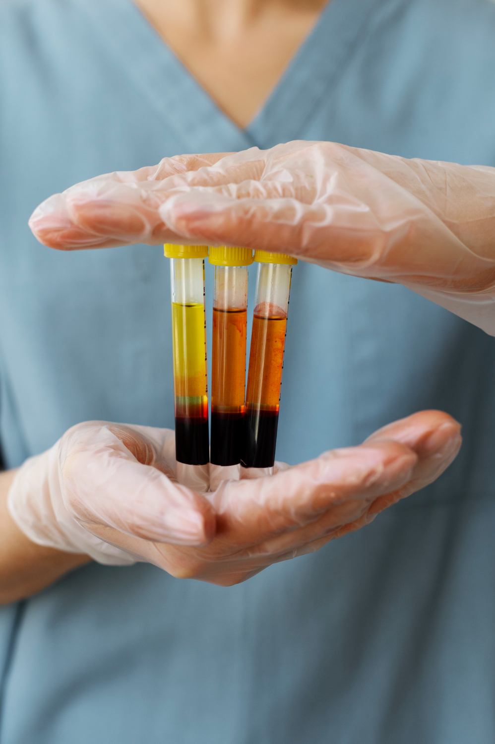 Cosmetic PRP Training Cosmetic PRP Training