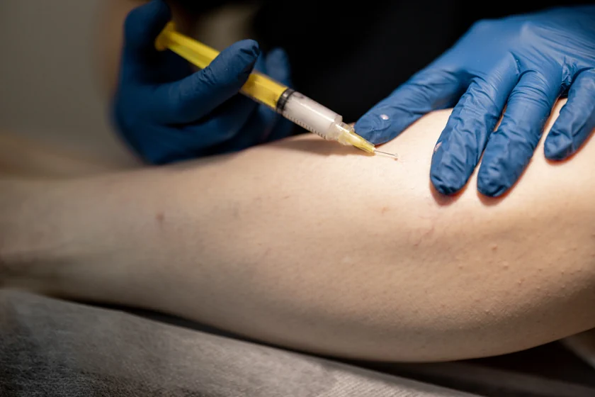 Cosmetic PRP Training